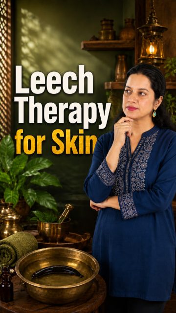 Struggling with varicose veins, swelling, joint pain or skin concerns? 🌿

Leech Therapy, known in Ayurveda as Jalaukavacharana, is an ancient therapy that may support better blood circulation, detoxification, pain relief and wound healing.

At Ayur Health Veda, Dharamshala, this therapy is performed with proper care, hygiene and Ayurvedic guidance.

Book your consultation today.

📞 7018272566
📍 Sidhpur, Dharamshala

[Leech Therapy, Jalaukavacharana, Varicose Veins, Joint Pain, Skin Health, Blood Circulation, Detox Therapy, Wound Healing, Ayurveda Clinic, Ayur Health Veda]

#LeechTherapy #Ayurveda #Panchakarma #NaturalHealing #Dharamshala